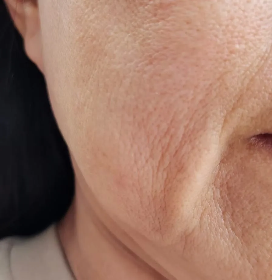 Dullness, Texture & Ageing Skin