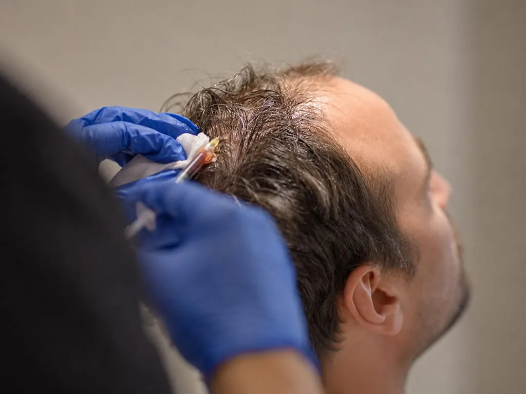 Hair Loss / Thinning Treatment
