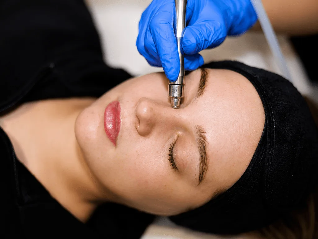 Microdermabrasion