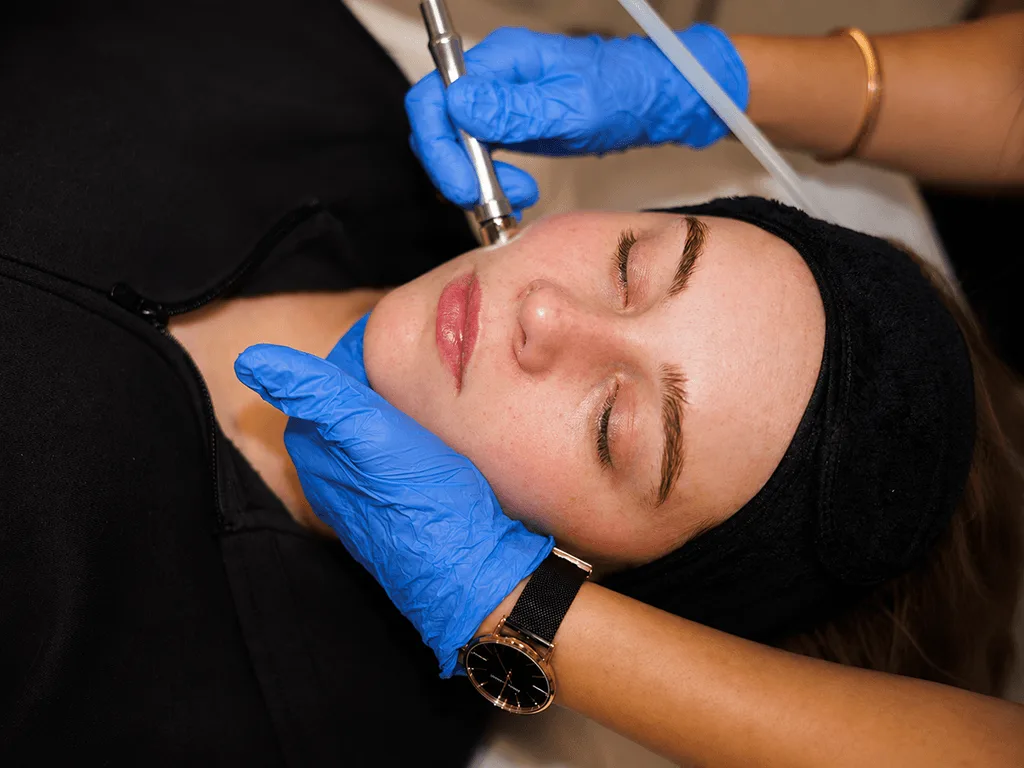 Diamond Microdermabrasion