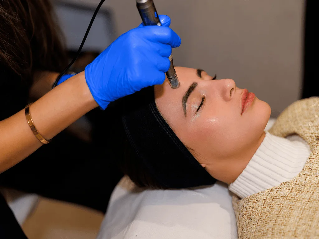 Microneedling